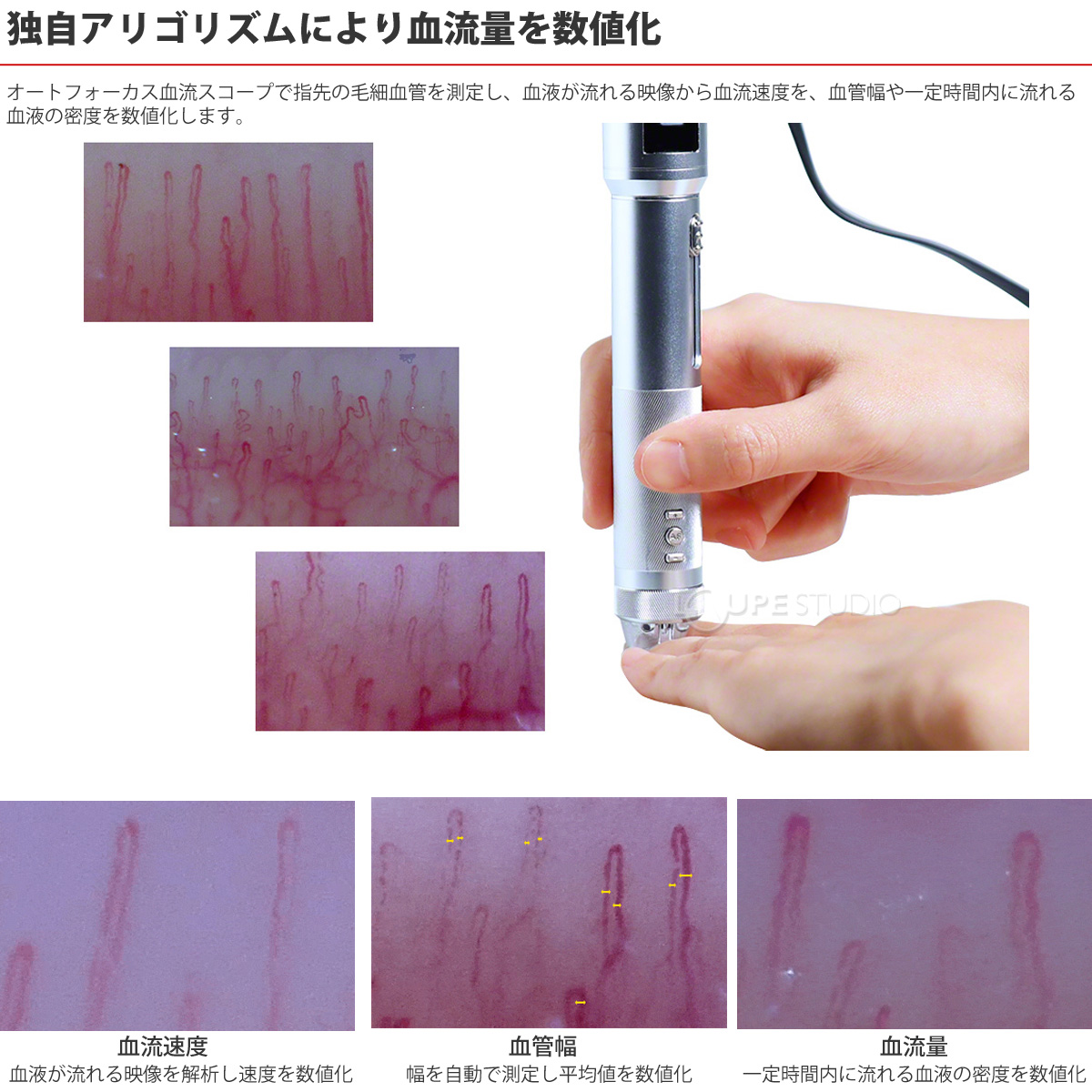 独自アリゴリズムにより血流量を数値化 