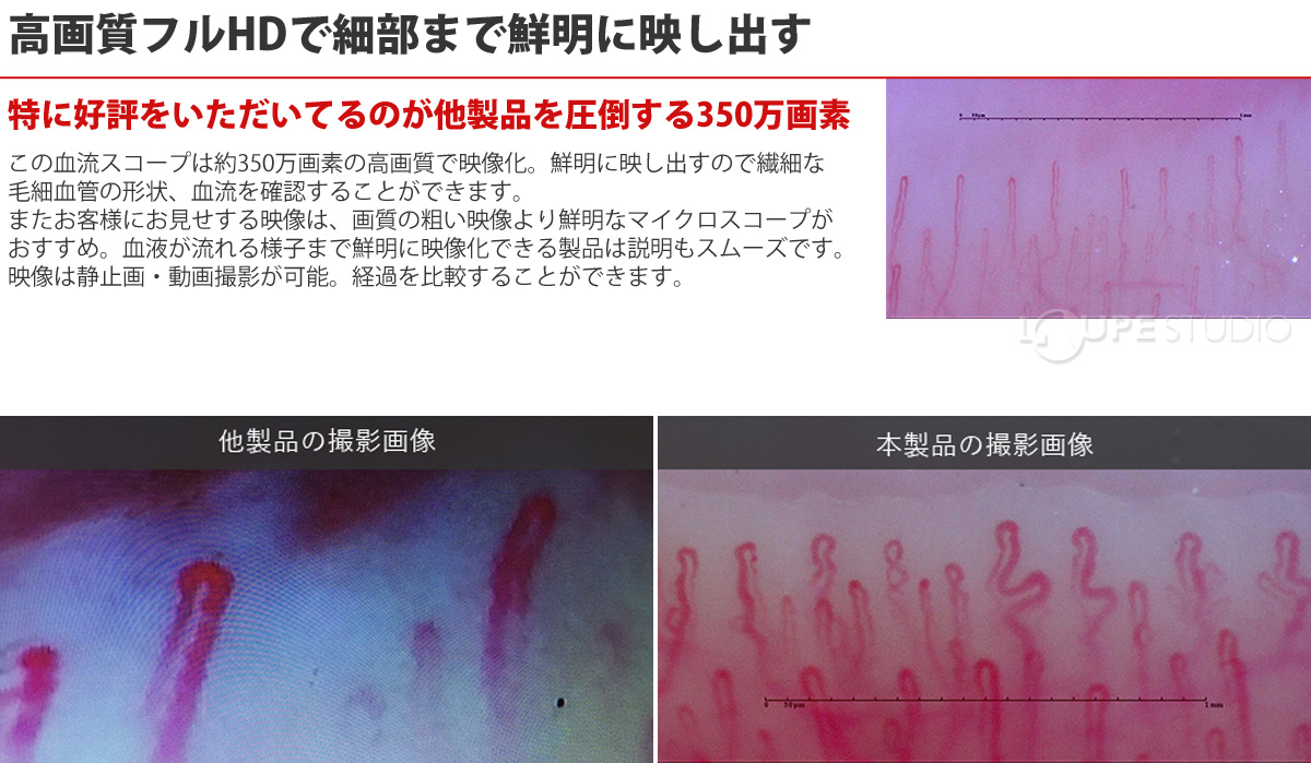 顕微鏡 頭皮 肌 指用血流観察オートフォーカスマイクロスコープ 顕微鏡 頭皮 肌 指用血流観察オートフォーカスマイクロスコープ