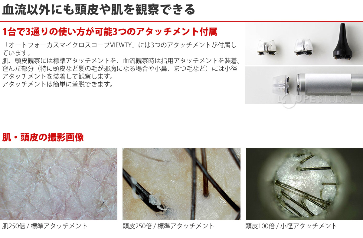 血流以外にも頭皮や肌を観察できる 