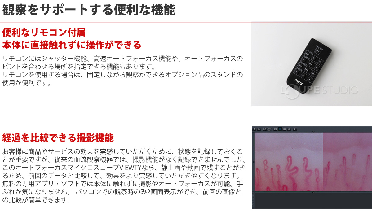 希少!!】 極美品 頭皮血流観察オートフォーカスマイクロスコープ