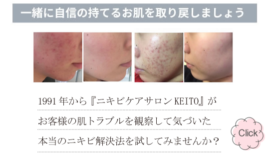 KEITOルナレーナ化粧品 - Yahoo!ショッピング