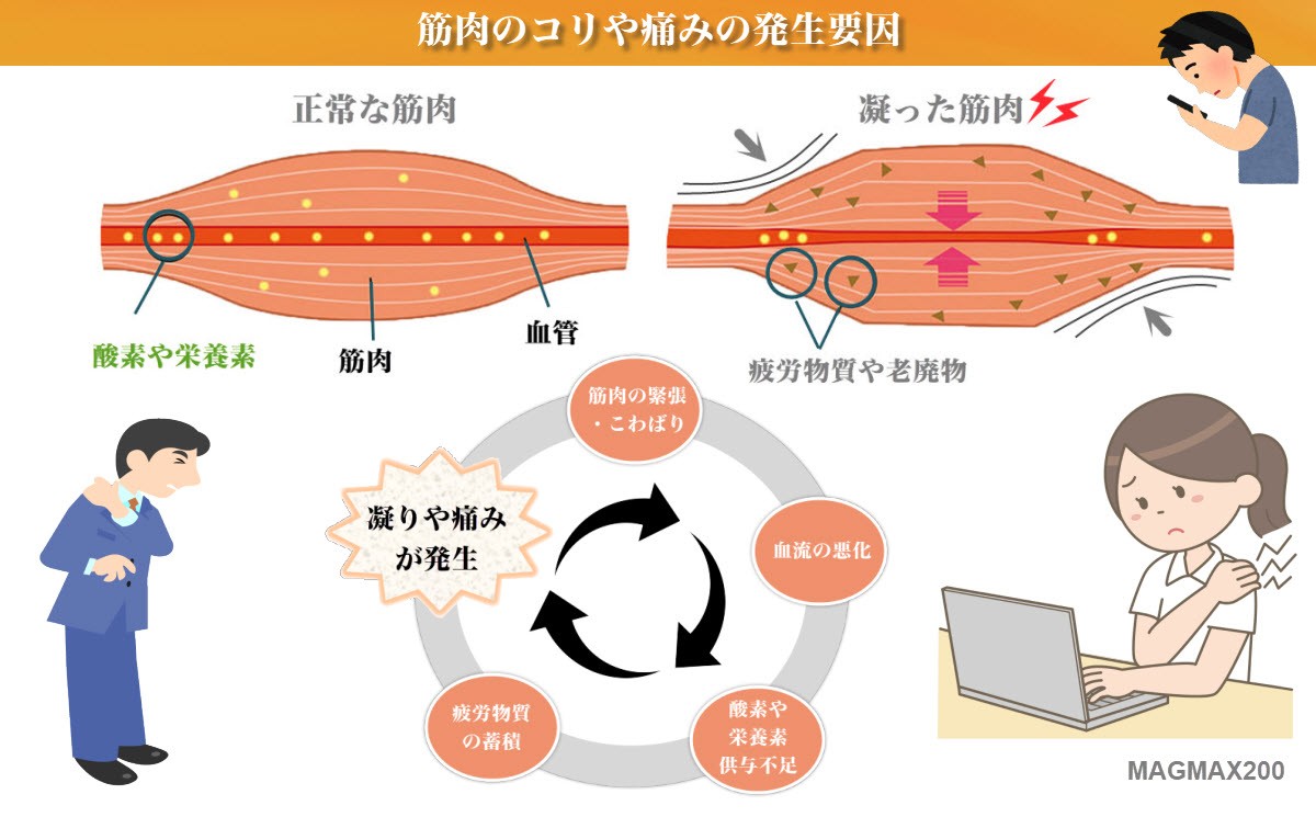 MAGMAX200磁気治療器はどうやって凝りに作用するの?