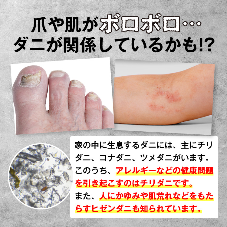 リボネルEX