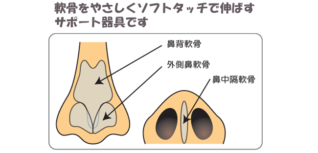 ハイコ