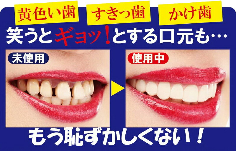 ワンタッチ スマイル (smile) 付け歯 前歯 歯 入れ歯 疑似歯 疑似入れ歯 すきっ歯 かけ歯 口元 極薄 義歯 歯並び 付歯 偽歯  インスタント : fke0404 : 日本通販ショッピング - 通販 - Yahoo!ショッピング