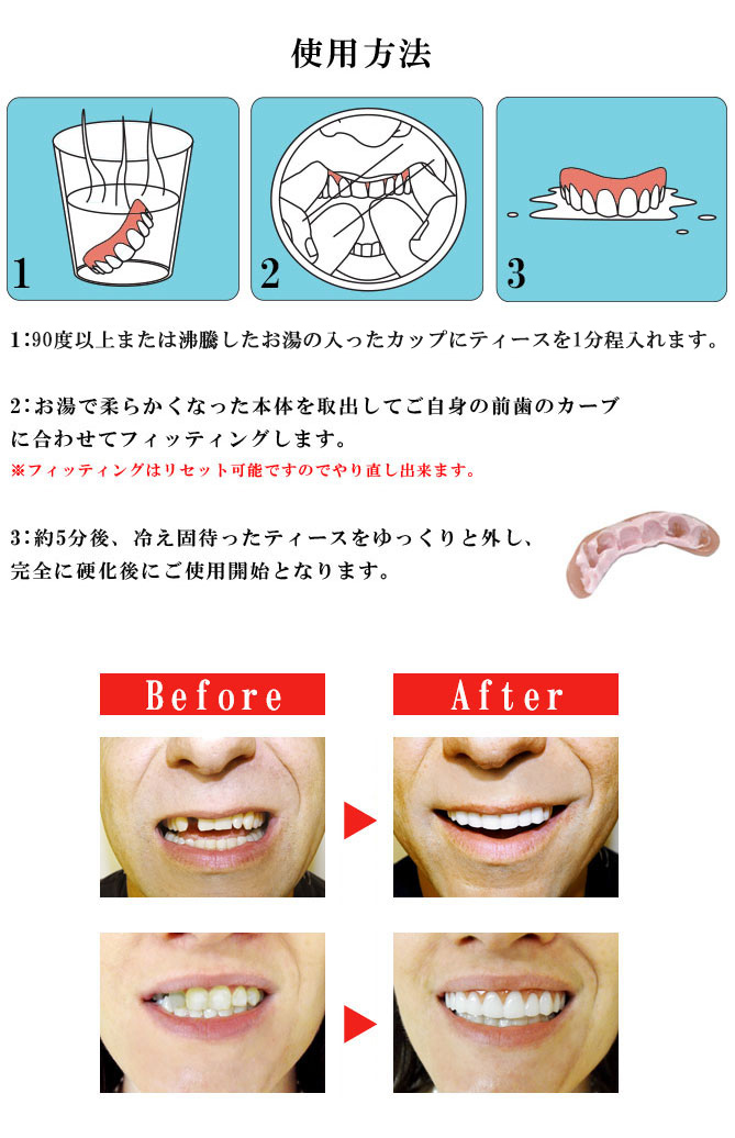 instantsmile(インスタントスマイル) インスタントスマイルティース