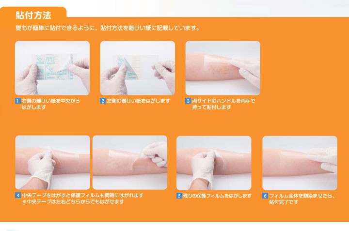 5％OFF smithnephew オプサイト クイックロール 2Way 10ｃｍ×12m 1巻入