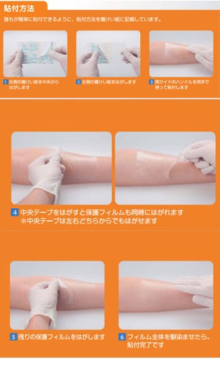 smith&nephew オプサイト クイックロール 2Way 15ｃｍ×12m 1巻入