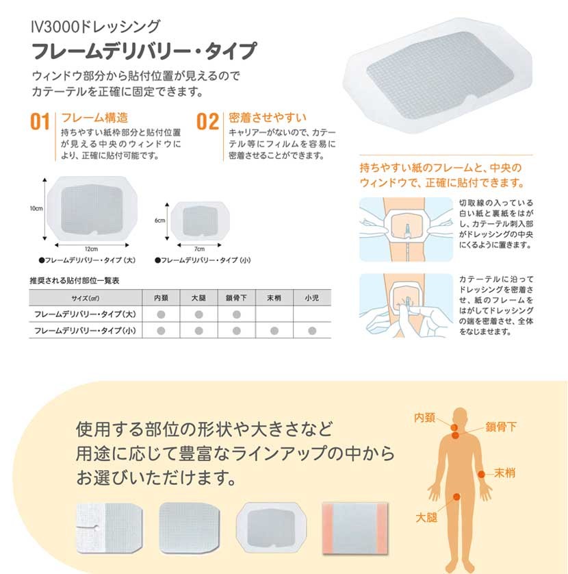 smith&nephew IV3000ドレッシング フレームデリバリー・タイプ 6×7ｃｍ