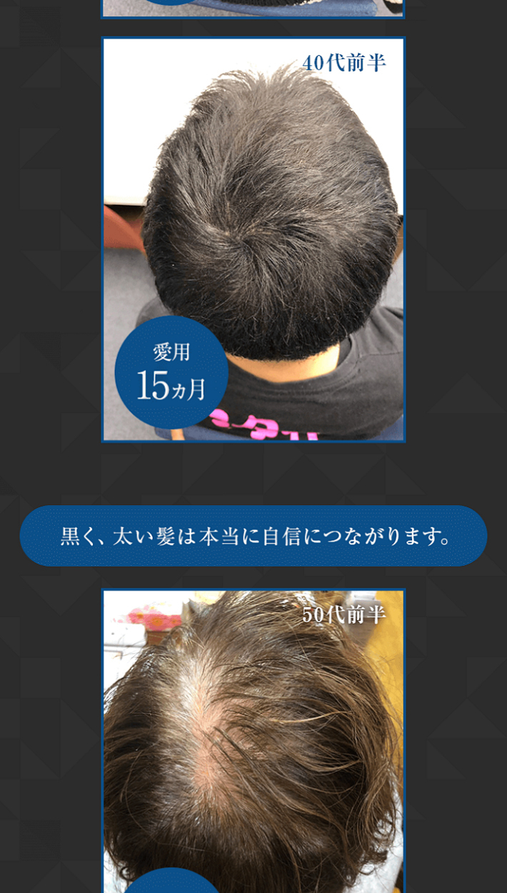 薄毛 白髪 対策 薬用 育毛剤 GROXIL ヘアトニック サプリ 医薬部外品 男女兼用 発毛剤 養毛剤 男性 用 女性用 抜け毛 予防 男性 女 性  50代 60代 グロキシル