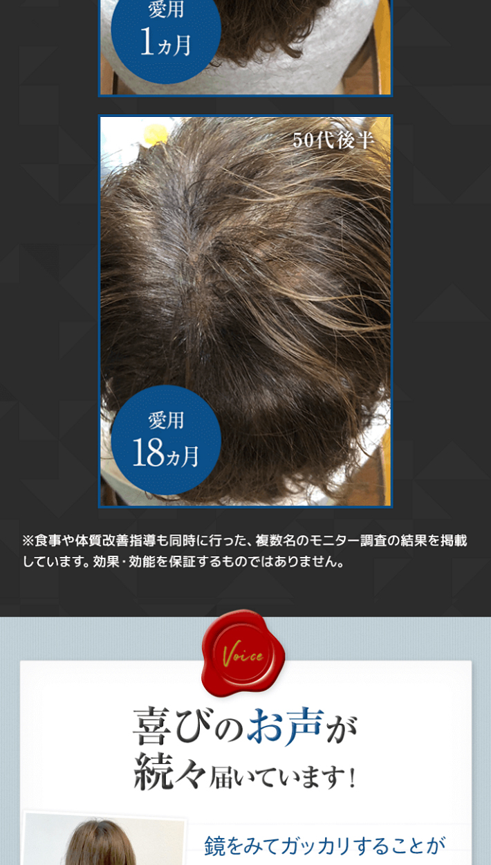 薄毛 白髪 対策 薬用 育毛剤 GROXIL ヘアトニック サプリ 医薬部外品 男女兼用 発毛剤 養毛剤 男性 用 女性用 抜け毛 予防 男性 女 性  50代 60代 グロキシル