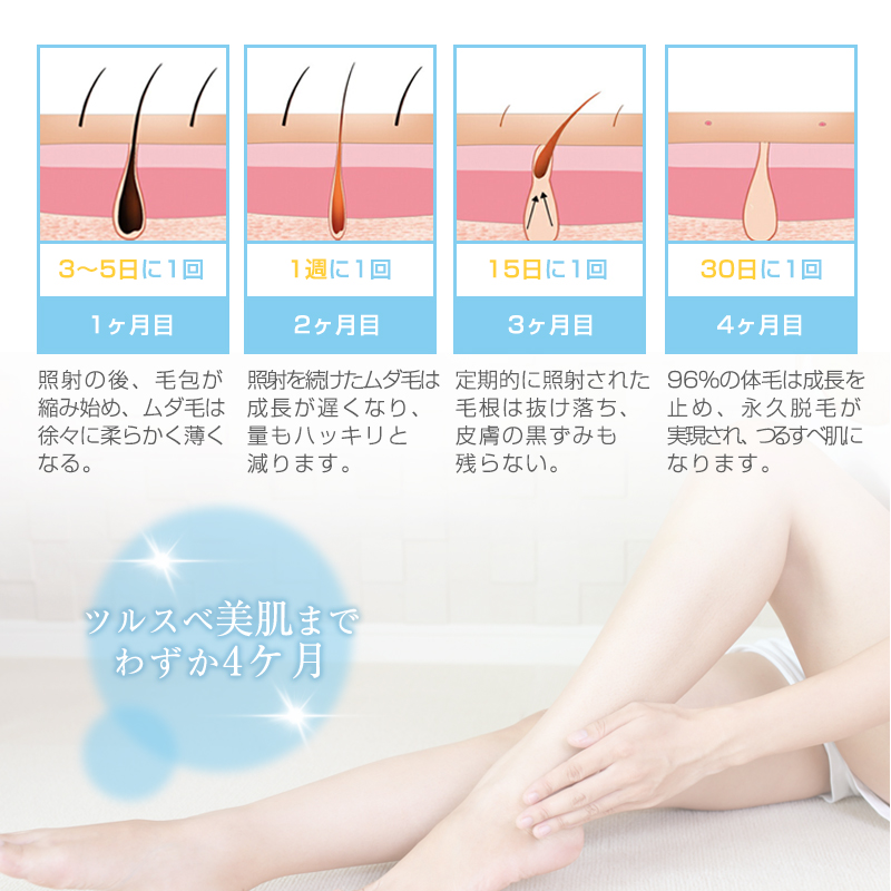 明誠 脱毛器 IPL光脱毛器 顔 髭 ワキ 腕 足 背中 ビキニライン