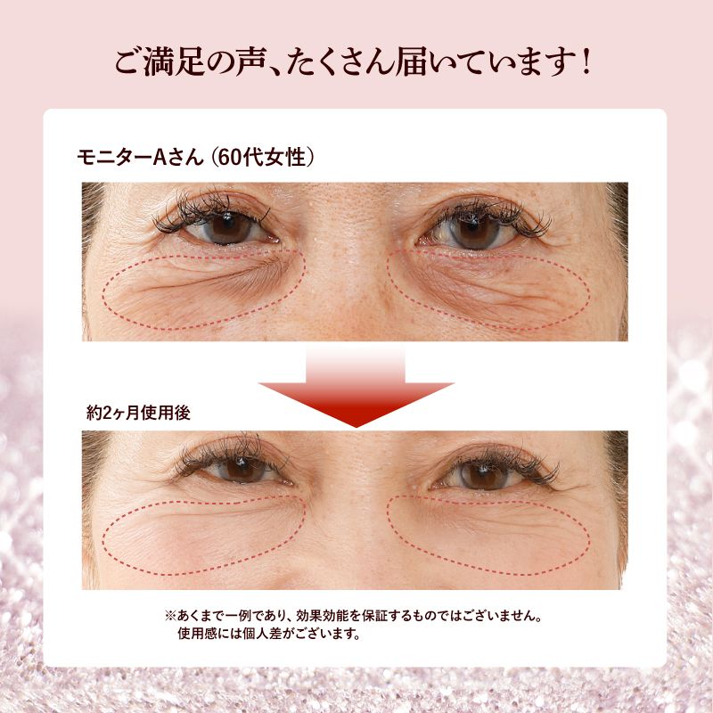 HUMANITY シワラップクリーム ヒト幹細胞 セラミド ラップ効果