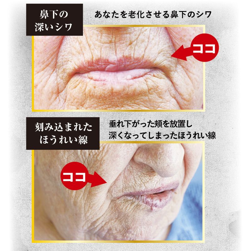 クイックヤングプレミアム スキンケア 鼻下のシワ 老け顔対策 シワ改善