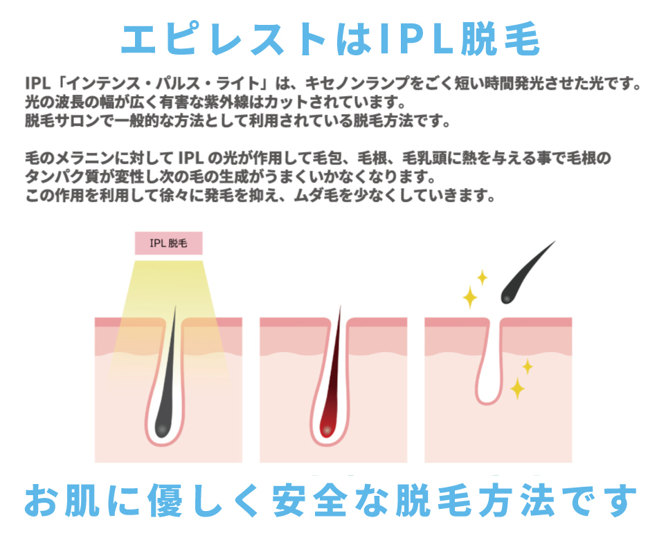 脱毛器 美顔器 ヒゲ脱毛 美容機器 エピレスト epirest direct 脱毛器 美顔器 ヒゲ脱毛 美容機器 エピレスト epirest direct