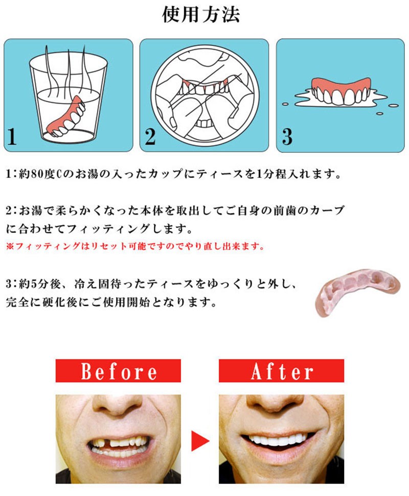 インスタントスマイル コンフォート薄型 仮歯 前歯 付け歯 簡単 接着 ワンタッチ 上歯 審美 歯が欠けた 差し歯が取れた 応急処置 口コミ  :sun41-1:美容と健康のミセルYahoo!店 - 通販 - Yahoo!ショッピング