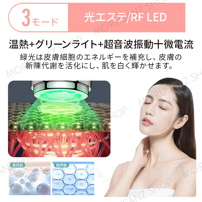 美顔器 超音波美顔器 イオン 導入 導出 リフトアップ 目元ケア LED