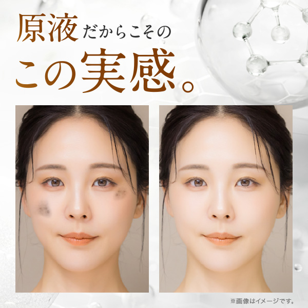 美白 美容液 しみ 対策 トラネキサム酸 くすみ 原液美容液 美白 美白化粧品 シミ シミ対策 人気 お試し エビスビーホワイト10ml プチギフト 爆買 | EBiS | 16
