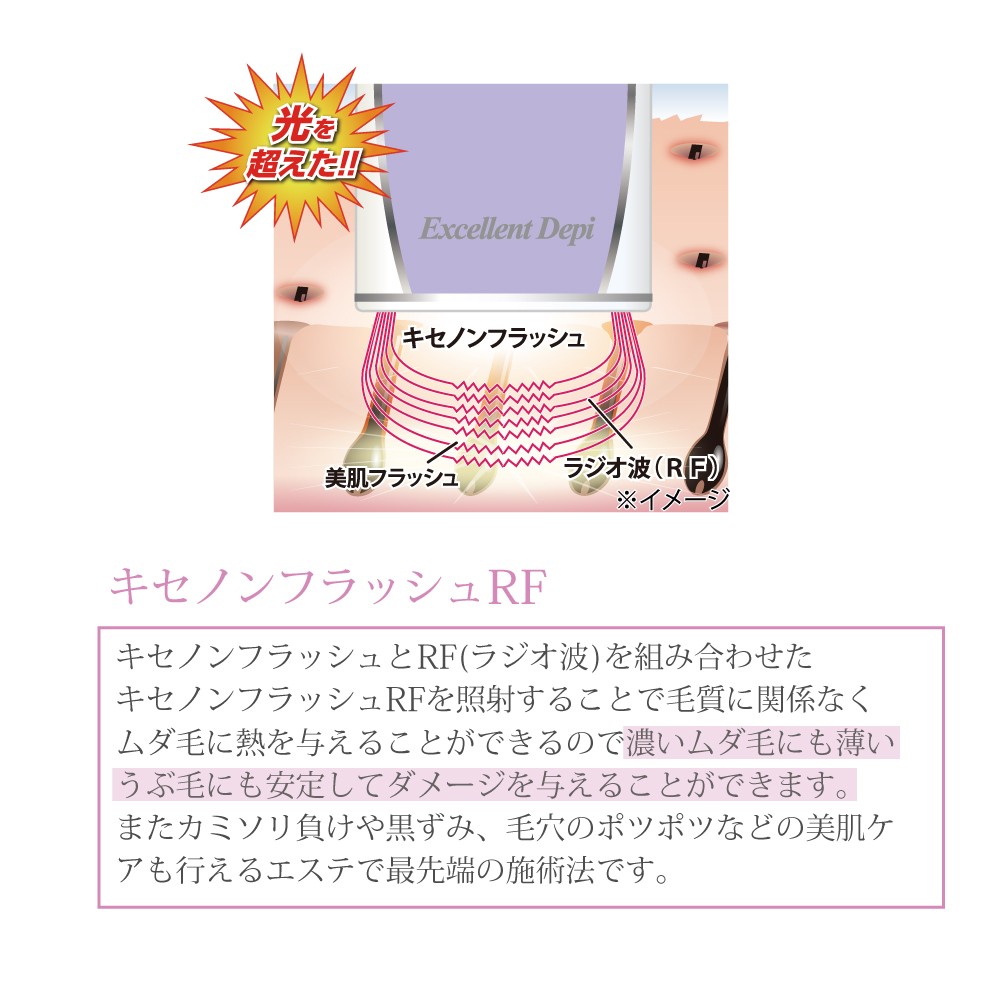 現金特価 光脱毛器 エクセレントデピ スピーディーrf 永久脱毛 脱毛器 フラッシュ脱毛 女性 Vio Vライン 全身 顔 髭 剛毛 スキンケア シミ取り 黒ずみ 日本製 新しいコレクション Kuljic Com