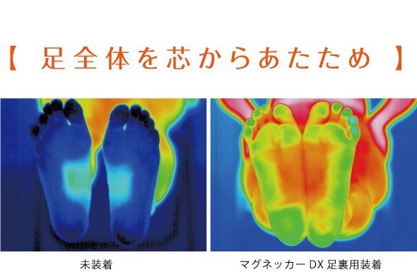 マグネッカーDX 足裏サポーター