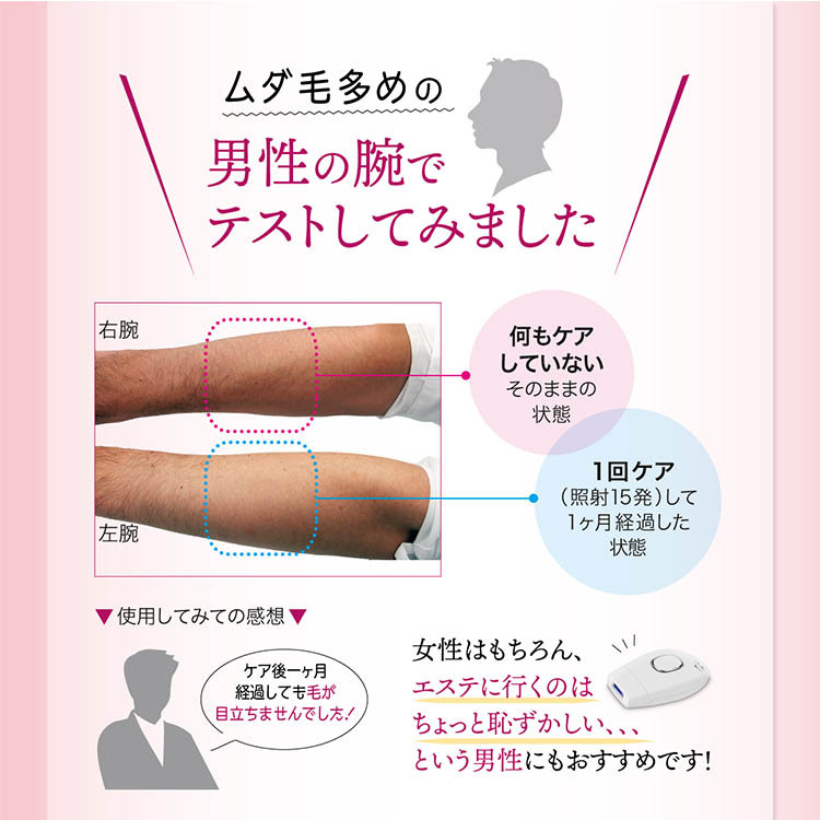 IPL光脱毛器 エピルミエ Epi Lumiere IPL Hair Remover 脱毛器