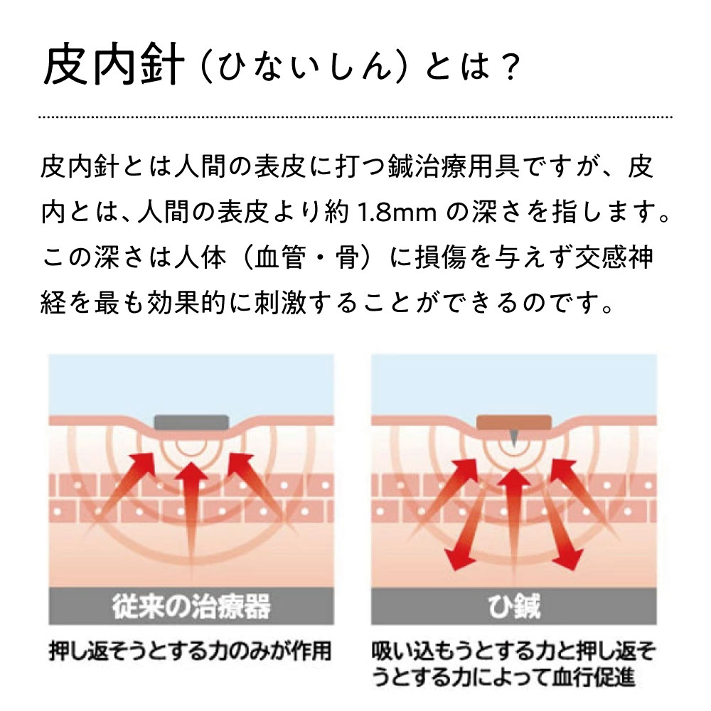 中山式 ひ鍼 24針