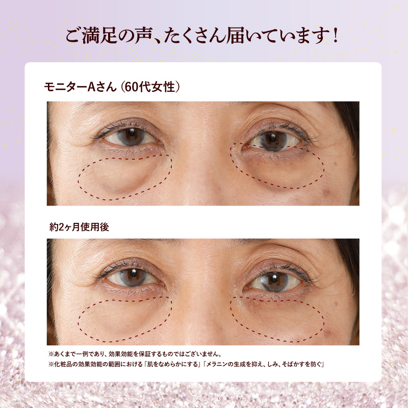 薬用BJレボリューションスティック 3g 美容美白スティック アイ