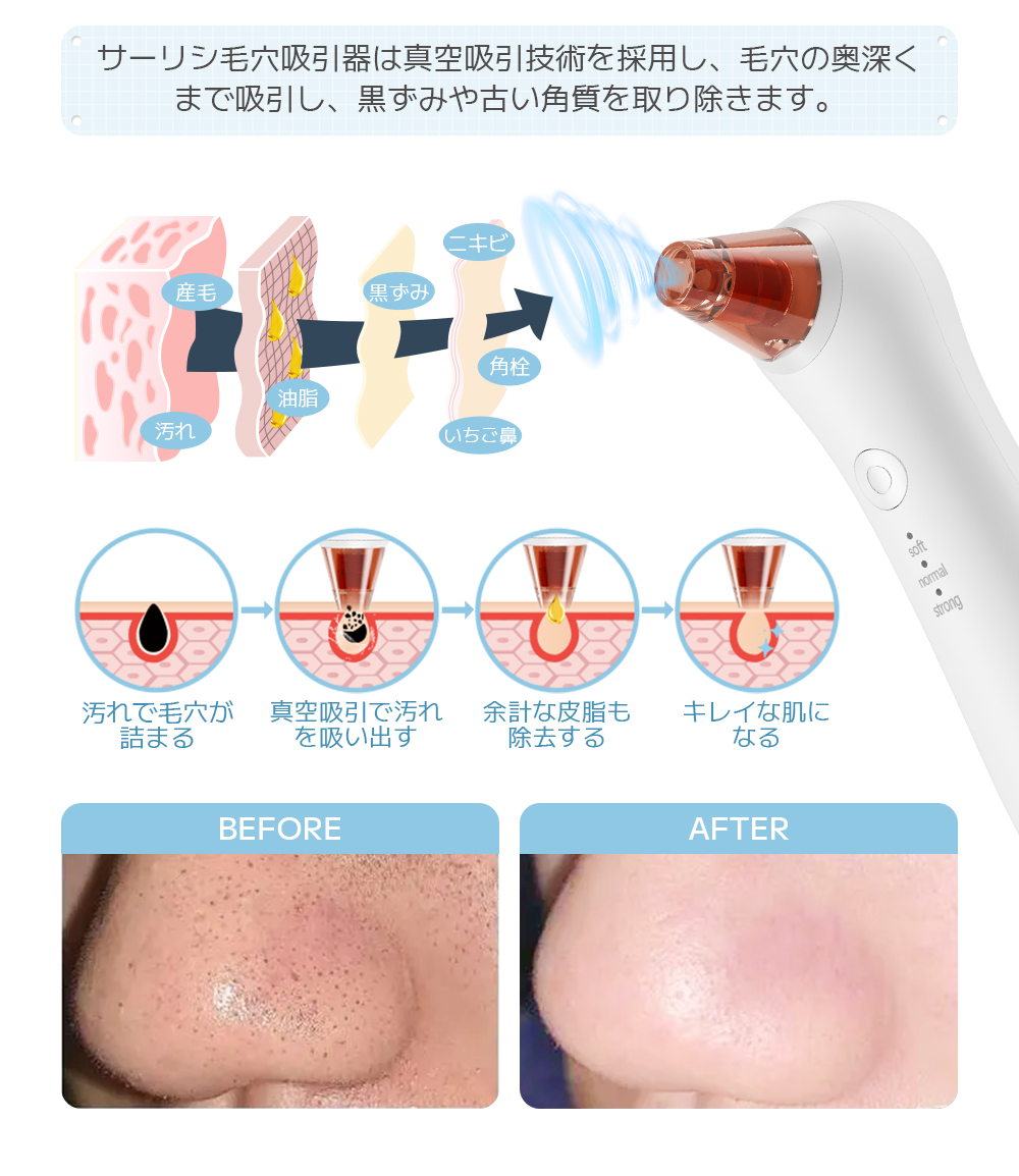 楽天 毛穴汚れ撃退❣️毛穴吸引器 角栓除去 毛穴 黒ずみ フェイシャル