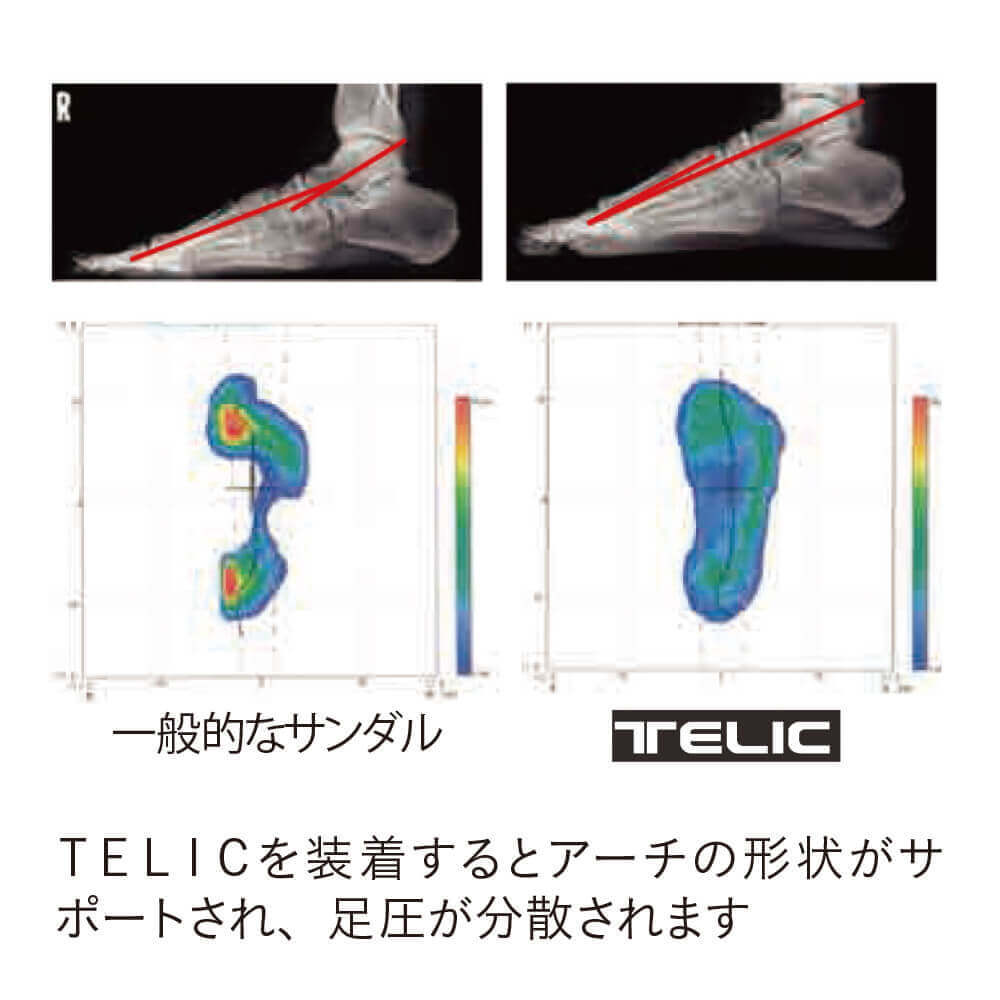 アーチの形状がサポ―トされ、足圧が分散