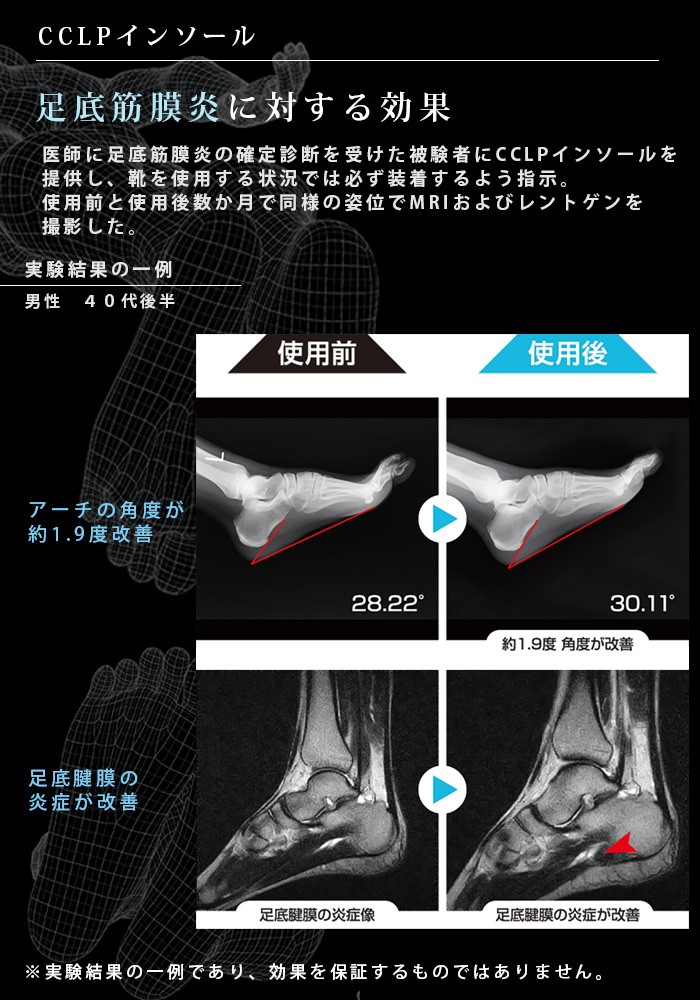 BMZ インソール メンズ レディース プロ アスリート 仕様 中敷き 