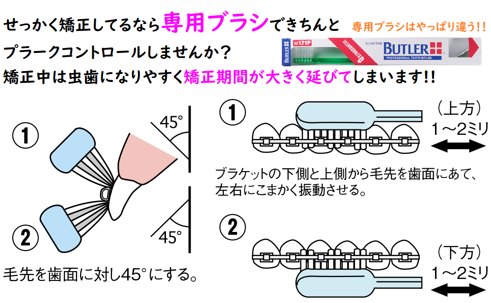 バトラー121P