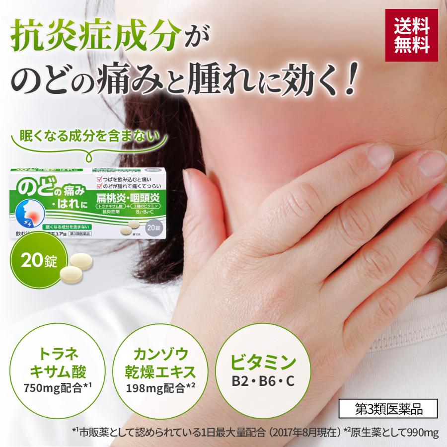 喉の痛み 医薬品 薬 ソアキュア錠 20錠 2...の詳細画像1