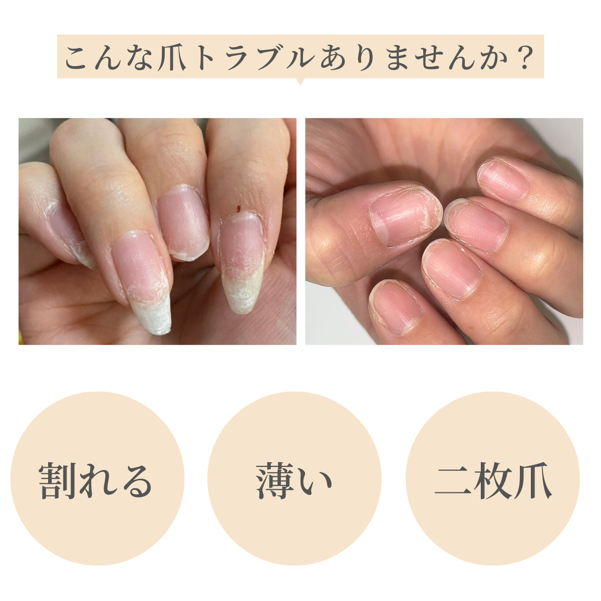 国内正規品 OPI(オーピーアイ) ネイルエンビーNL-223 Pink to Envy(ピンク トゥ エンビー)(カラー＋爪強化剤) ネイルケア : opi-nl-p223:マニキュア通販・大人ネイル - 通販 - Yahoo!ショッピング