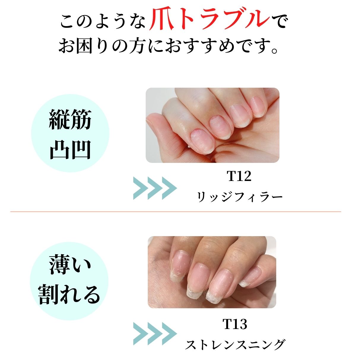 Opi Infinite Shine オーピーアイ インフィニットシャイン ケアベースコート 15ml 凹凸 縦スジ 爪が薄い 割れ 乾燥 色味 黄ばみ 対策 Inf Care Oll マニキュア通販 大人ネイル 通販 Yahoo ショッピング