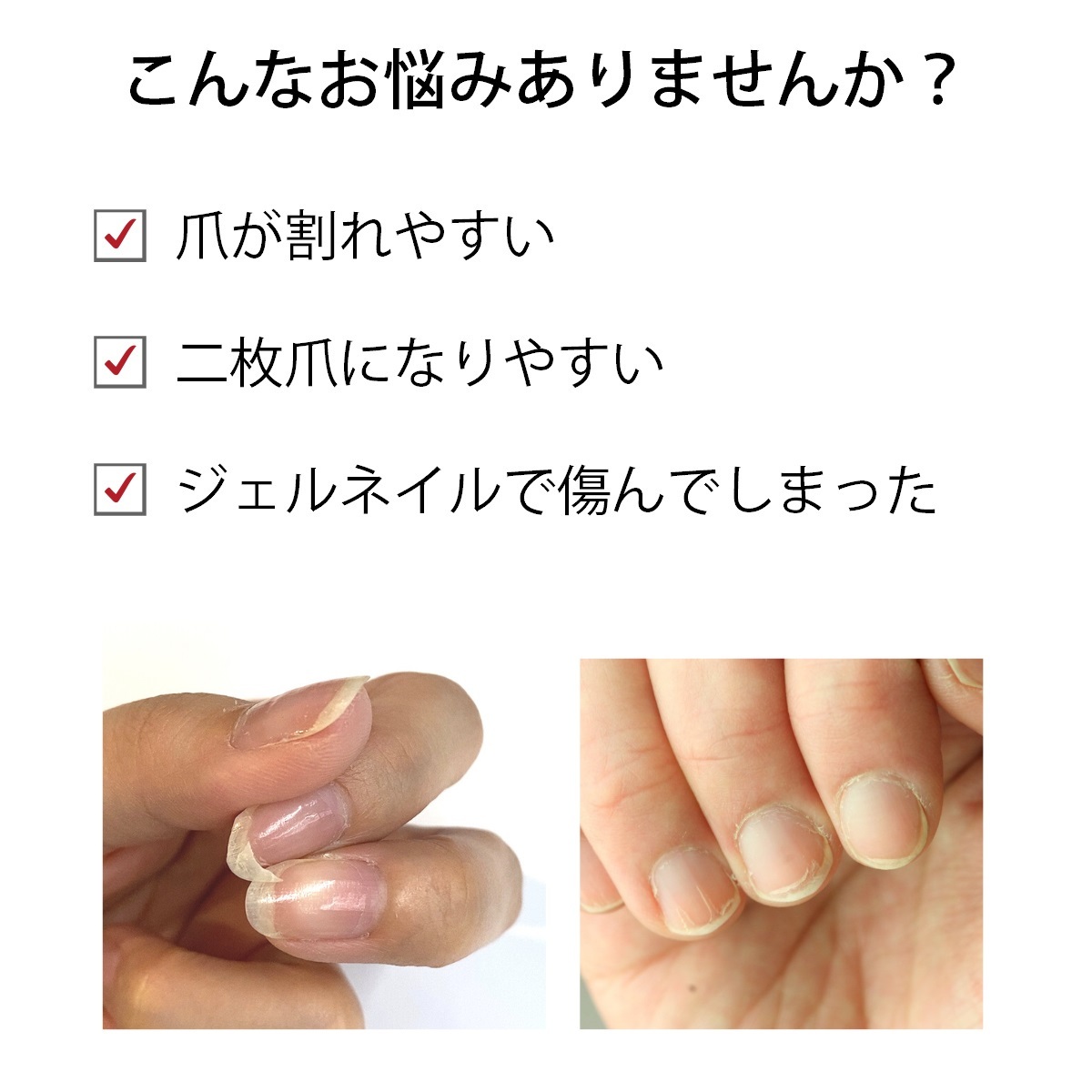 宅配送料無料】爪割れ防止 ネイルケアセット OPI オーピーアイ ネイルエンビー 大人ネイル アセトンフリー リムーバー 爪割れ 薄爪 二枚爪  ネイルケア :tumeware-set6:マニキュア通販・大人ネイル - 通販 - Yahoo!ショッピング