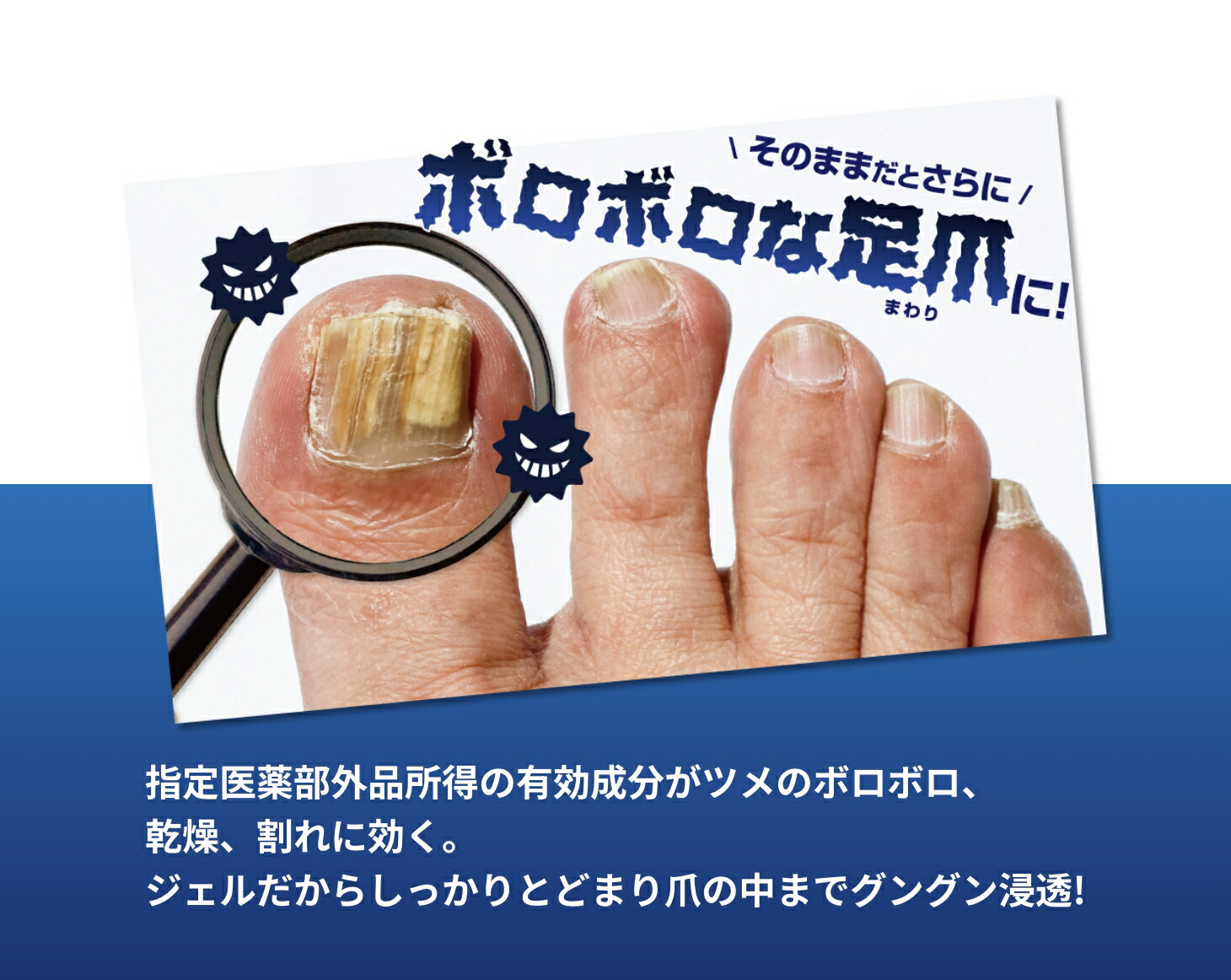 薬用足爪ジェル 2本組 爪水虫対策 殺菌 消毒 爪まわり ケア 医薬部外品