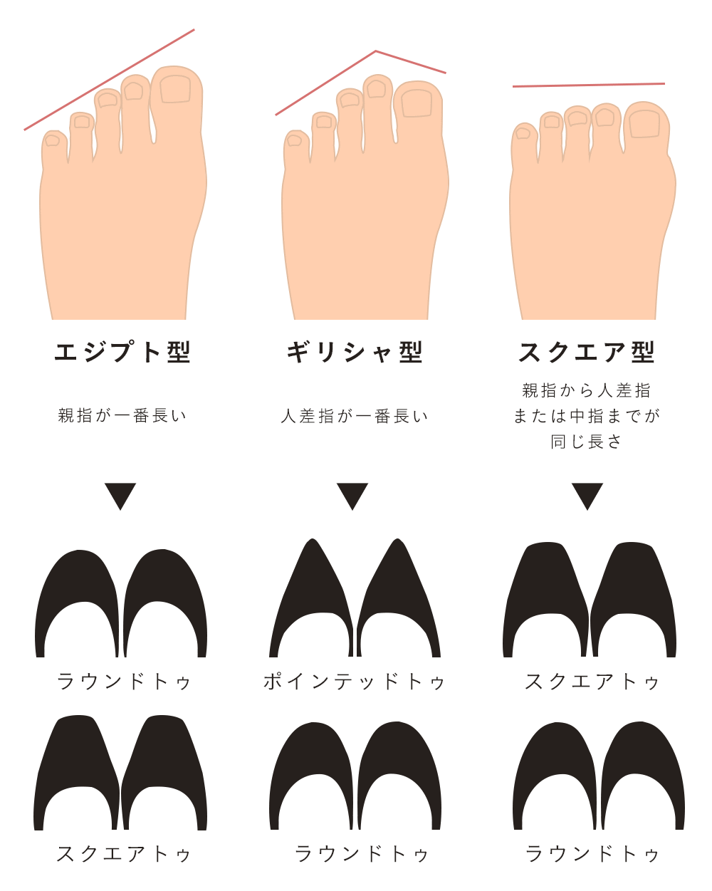 外反母趾に優しい靴の選び方