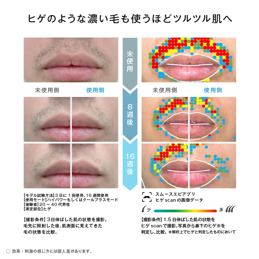 公式店 パナソニック 光美容器 スムースエピ ES-WG0Bの画像
