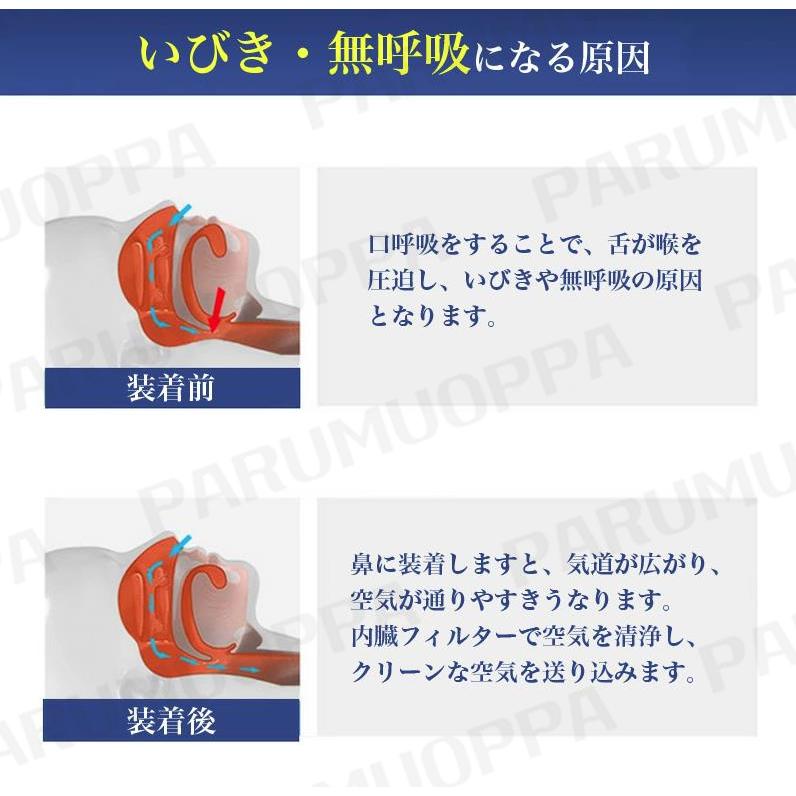 睡眠改善＆送料無料】いびき防止 グッズ 鼻 睡眠改善グッズ USB充電式 いびき対策 呼吸対策 鼻呼吸促進 安眠グッズ 落下防止 疲れ取る 空気清浄機  鼾防止 : cai456 : parumuoppa - 通販 - Yahoo!ショッピング