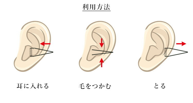 究極の耳毛抜き 毛抜き 関魂（NKKS） カラー3