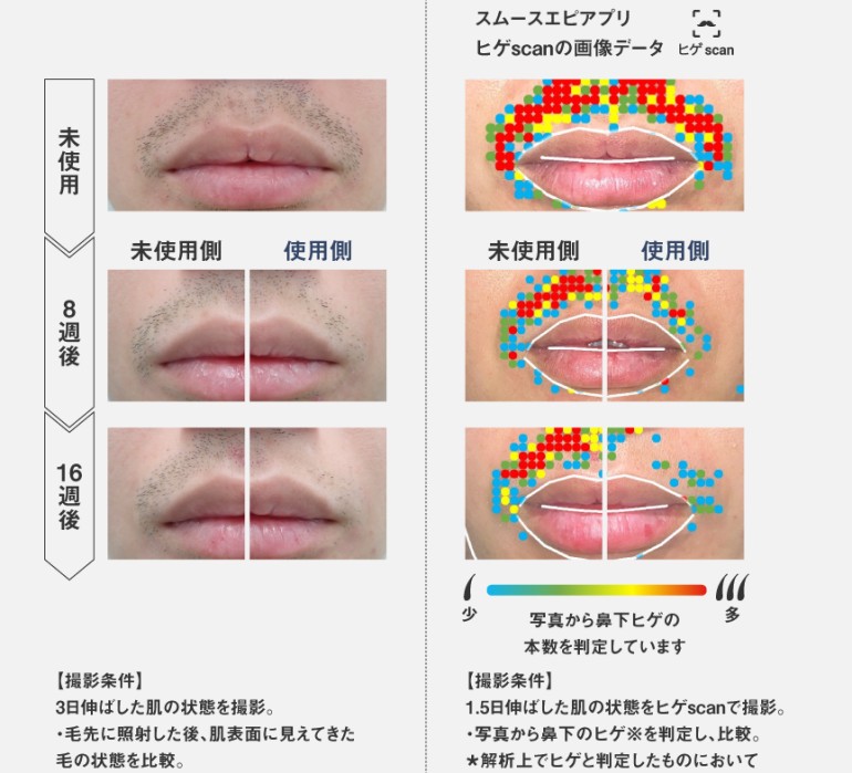 Panasonic（パナソニック） 脱毛器 ES-WG0B-H 光エステ スムースエピ
