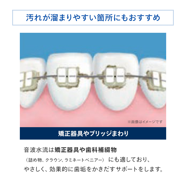 汚れが溜まりやすい箇所にもおすすめ