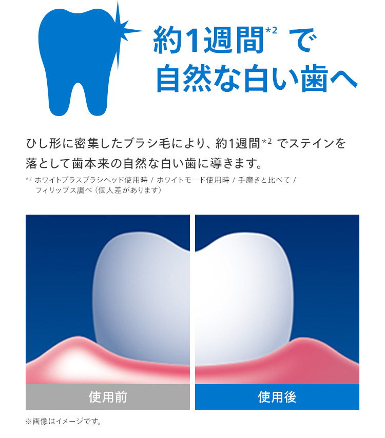 約1週間*2で自然な白い歯へ 