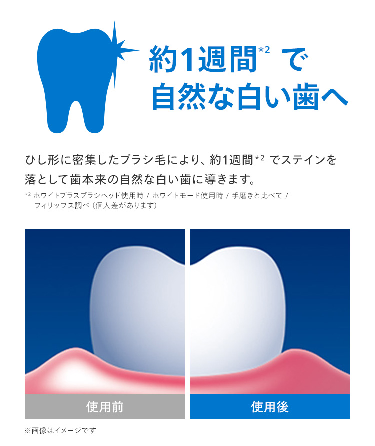 約1週間*2で自然な白い歯へ