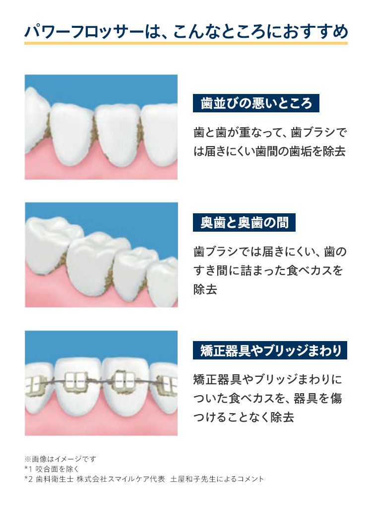 パワーフロッサーは、こんなところにおすすめ