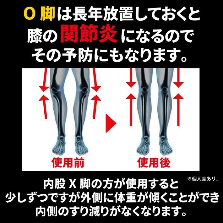Amazon.co.jp: o脚矯正 o脚矯正グッズ 脚姿勢補正ベルト O 型 X