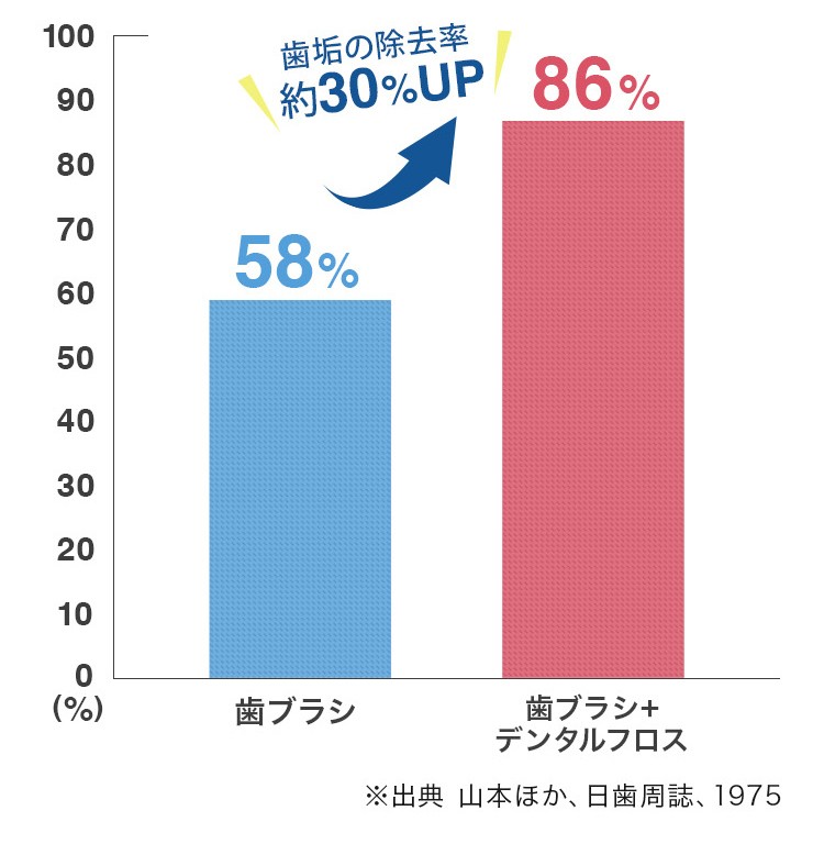 歯垢の除去率30％アップ