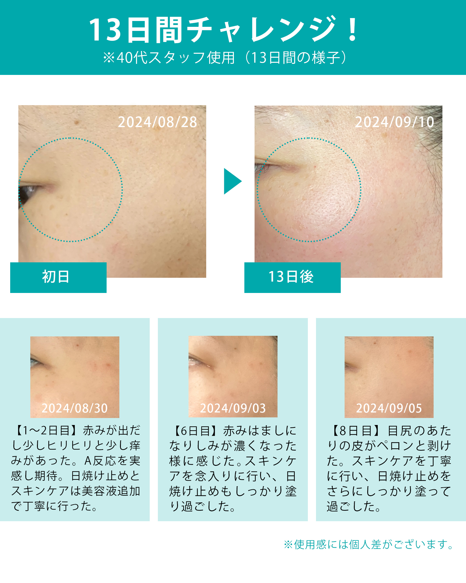 クリーム MARKAID マークエイド ハイドスピキュール 15g 純