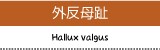 外反母趾