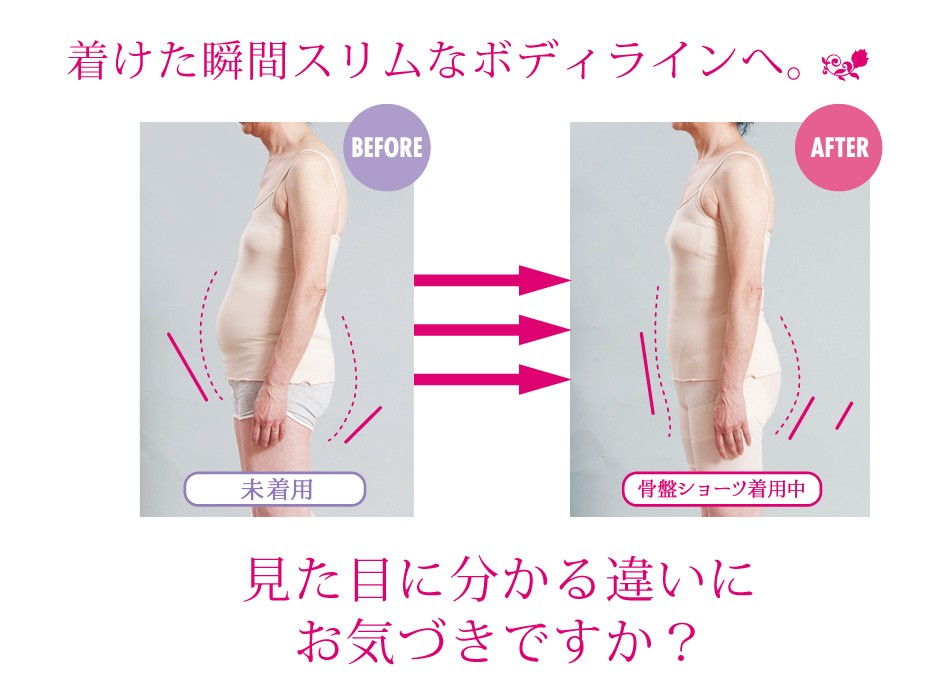 Before/After
